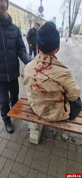 Власти Пскова отреагировали на инцидент с падением пенсионера на скользком тротуаре